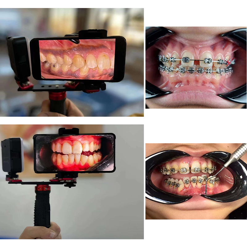 Dentistry Material Mobile Phon - Photography Mobile Lighting avis et prix